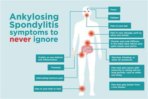 Common Ankylosing Spondylitis Signs and Symptoms