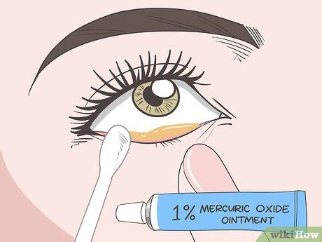 3 Ways to Treat Eyebrow and Eyelash Lice - wikiHow