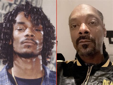 Snoop Dogg Hair Loss