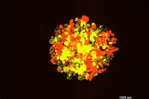 Shared Resistance in Breast Cancer Cells | College of Science