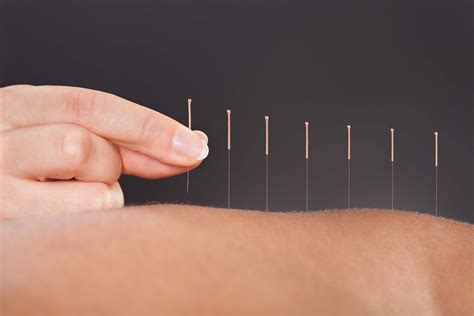 The ancient therapy of acupuncture has modern science to back up its ...