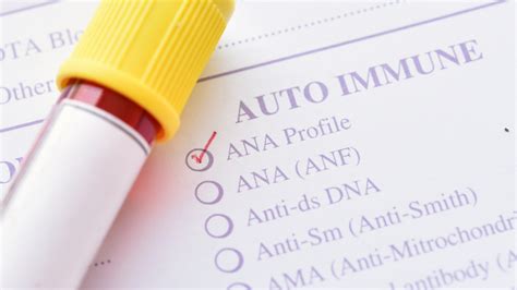 What does your "ANA Pattern" mean? • Connected Rheumatology