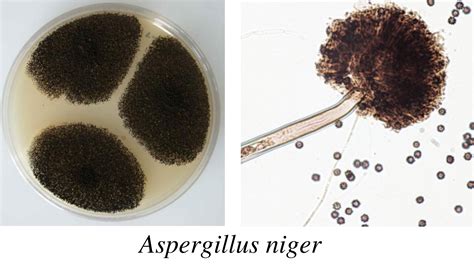 Aspergillus: Morphology, Clinical Features, and Lab Diagnosis • Microbe ...