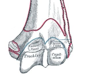 Intercondylar Fracture of Humerus, its Physiotherapy : Physiosunit