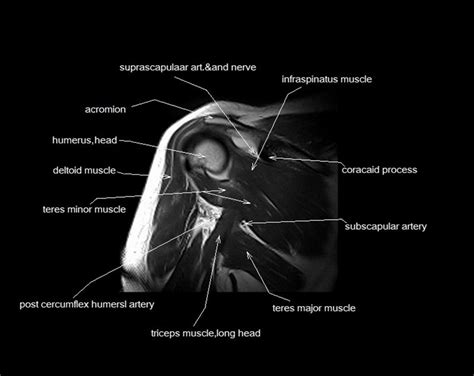 Knee Muscle Anatomy Mri / knee anatomy | MRI knee coronal anatomy | free cross ... : These ...