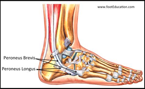 Acute Peroneal Tendon Subluxation - FootEducation