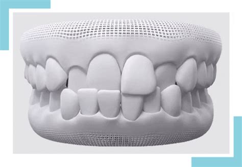 Invisalign Dentist - Clear alternative to metal braces for all.