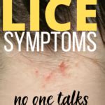 17 Lice Symptoms with Pictures: Signs That You Have Head Lice - My Lice Advice