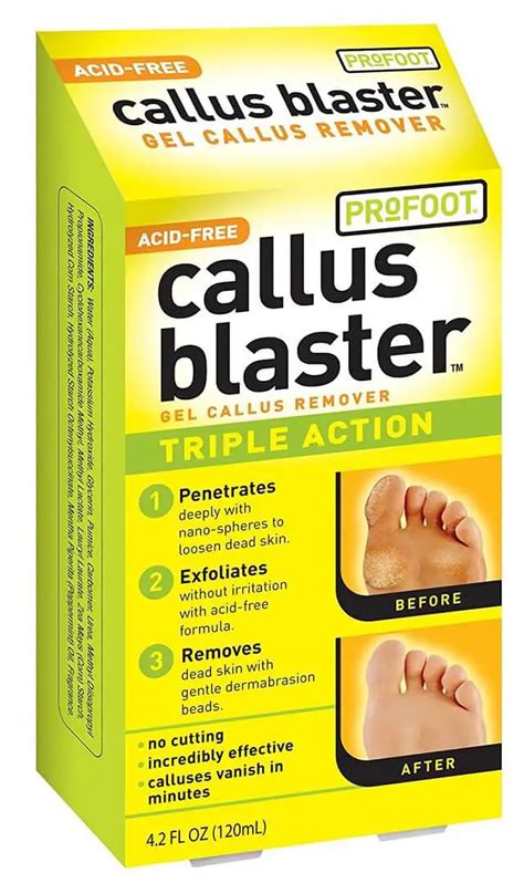 Best Callus Remover Gel: Say Goodbye to Calluses - For Your Massage Needs