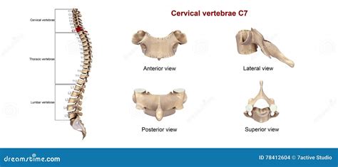 Cervical Vertebrae C7 Royalty-Free Stock Photo | CartoonDealer.com #78412563