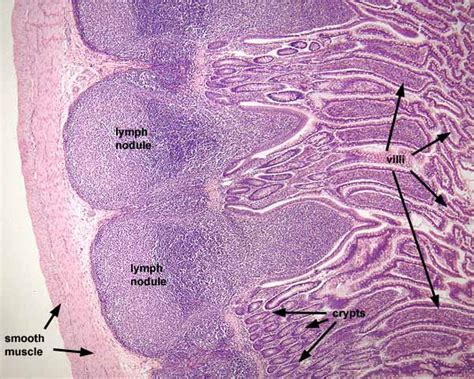 Histology Of Ileum Peyers Patches