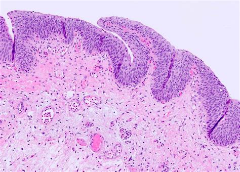 Urinary Bladder Histology Detrusor Muscle