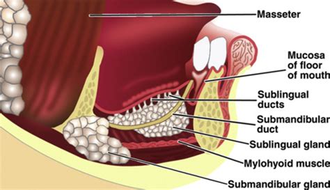 Excision of Sublingual Gland - Oral and Maxillofacial Surgery Clinics