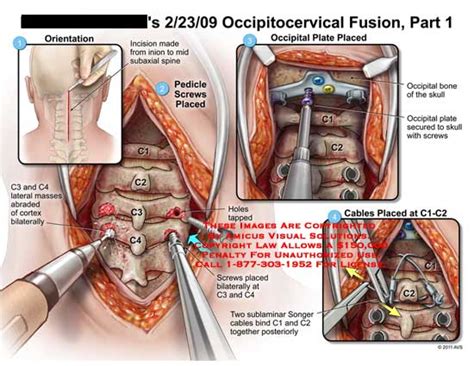 Medical Exhibits, Demonstrative Aids, Illustrations and Models