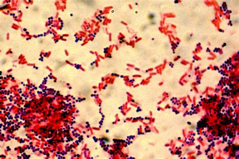 Gram Positive vs. Gram Negative Bacteria