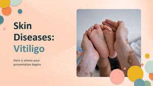 Skin Diseases: Vitiligo PowerPoint Templates Free Download