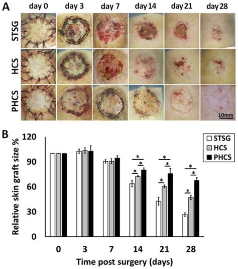 Pre-vascularization Enhances Therapeutic Effects of Human Mesenchymal ...