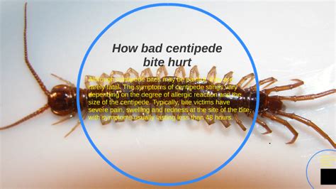 House Centipede Bite Symptoms