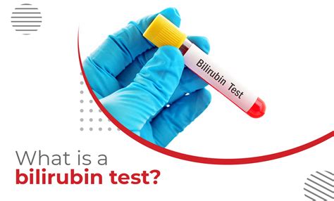 What is a bilirubin test? - Private Blood Tests London