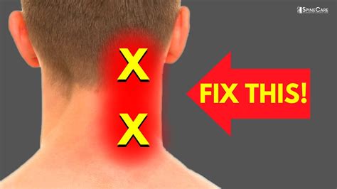 How to Fix Neck Pain off to the Side - YouTube