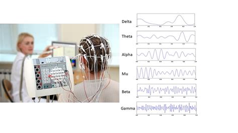 Eeg Brain Waves