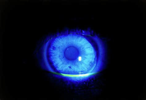 Normal Eye Highlighted With Fluorescin Under Uv Photograph by Rory ...