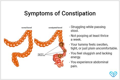 Constipation: Common Causes, Symptoms, Treatment, & More