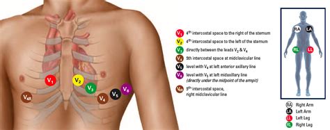 EMS STAT 12-Lead | Stat Medical Education | 12 lead ekg placement, Ekg placement, Paramedic school