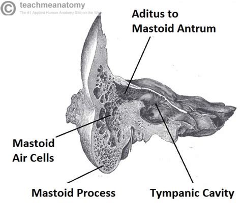 The Temporal Bone - Parts - Fractures - TeachMeAnatomy