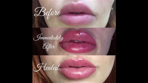 Permanent lip tattoo healing process kit - Tempe 61 Best Permanent makeup images - Makeup Lips ...