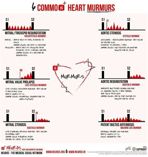 Heart murmurs | Heart s | Pinterest | Heart and Heart murmur