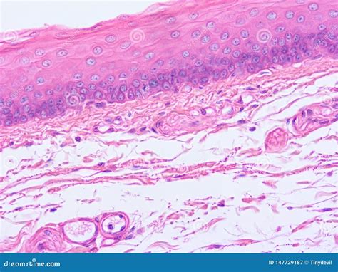 Histology of Epiglottis Human Tissue Stock Image - Image of view, epiglottis: 147729187