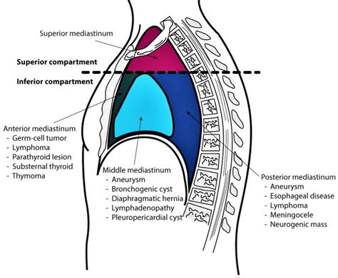 Mediastinum anatomy, location, cavity, organs, function & tumors