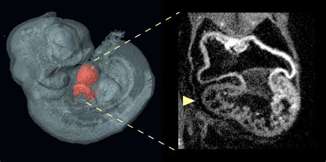 Risk factors for congenital heart defects may lie both inside and outside the heart