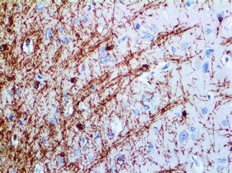 Myelin Basic Protein - Rabbit Polyclonal - Affordable Ihc Solutions