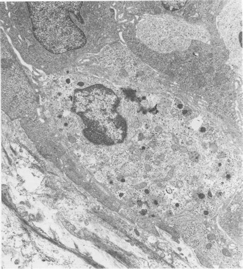 Electron microscope photomicrograph ofa natural killer cell present... | Download Scientific Diagram