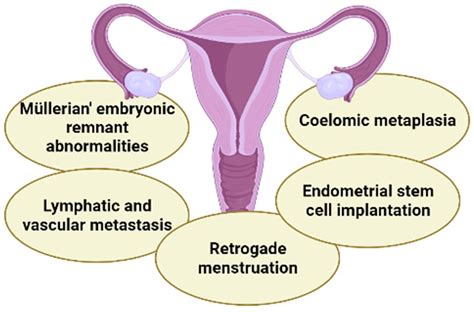 Molecules | Free Full-Text | Endometriosis: A Disease with Few Direct Treatment Options