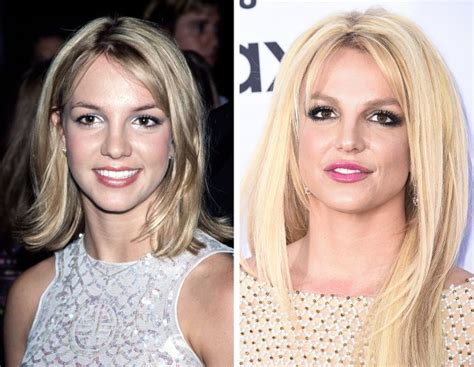 18 Celebs Who’ve Had Plastic Surgery and Don’t Try to Keep It a Secret / Bright Side