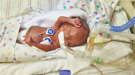 Artificial Womb Could Offer New Hope for Premature Babies