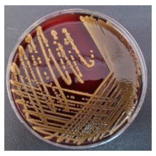 (PDF) Chryseobacterium indologenes Septicemia in an Infant