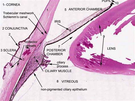 173 best images about Cytology & Histology on Pinterest | Stains, Small cell carcinoma and Lymph ...