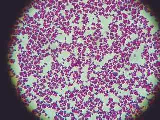 Lactococcus lactis. Observación microscópica con objetivo de 40x.... | Download Scientific Diagram