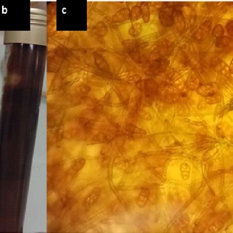 Characterization of Alternaria alternata colonies on front view (a) and... | Download Scientific ...