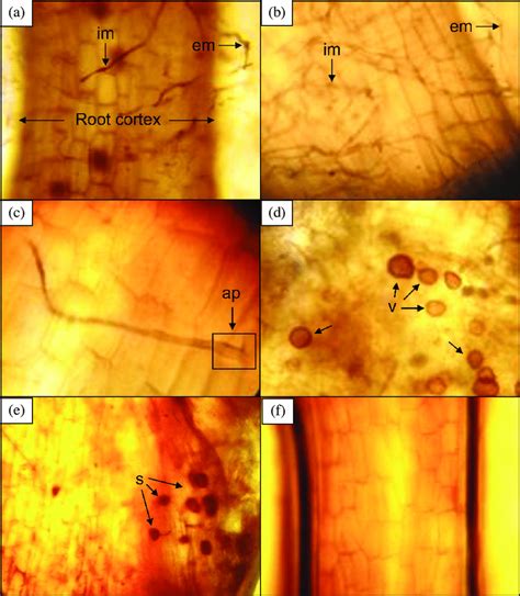 Mycorrhizal structures developed by arbuscular mycorrhizal fungi (AMF)... | Download Scientific ...