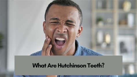 What Are Hutchinson Teeth?