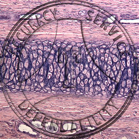 Cartilage Verhoeff's Elastic Tissue Stain Prepared Microscope Slide