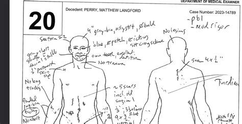 Matthew Perry Full Autopsy Report: Death Scene Details Released