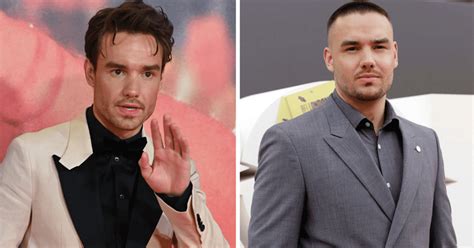 Did Liam Payne get cosmetic surgery? Singer's new look shocks fans | MEAWW