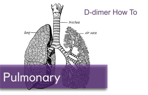 D-Dimer How To — NUEM Blog