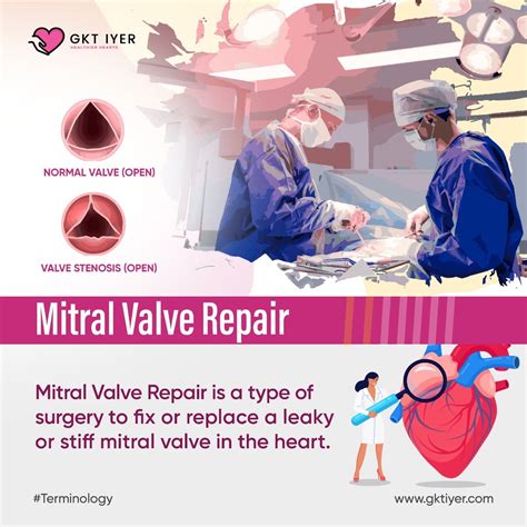 Mitral valve replacement is surgery to repair or replace a damaged or ...